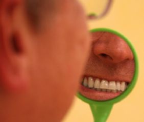 gingivitis parodontitis